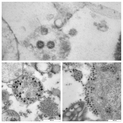 Представитель ВОЗ Жазаревич: течение вируса Нипах возможно без симптомов