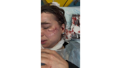 Делу по факту избиения королевы красоты в &laquo;Корстоне&raquo; Казани не дают хода